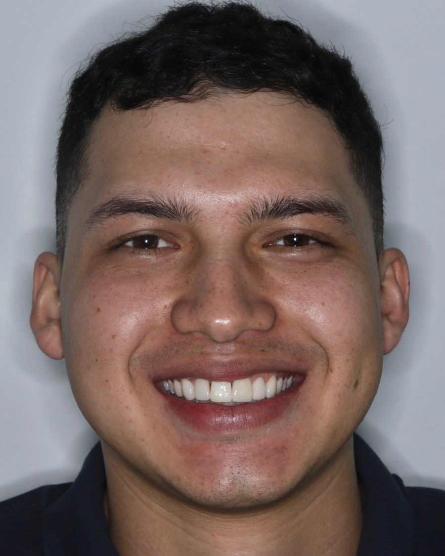 Paciente sonriendo después de su tratamiento